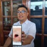 Seorang siswa kelas 4 SD Hj Isriati Moenadi, Ungaran Timur, Kabupaten Semarang, berinisial R diduga menjadi korban perundungan oleh teman sekelas pada Rabu (23/9/2026). R mengalami sejumlah memar, luka di belakang telinga, bibir pecah, serta trauma setelah kejadian. Pihak sekolah mengaku telah memberikan konsekuensi kepada siswa yang terlibat dan menyiapkan pembinaan serta upaya pemulihan kondisi psikologis korban.
