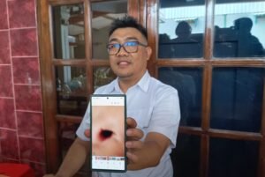 Seorang siswa kelas 4 SD Hj Isriati Moenadi, Ungaran Timur, Kabupaten Semarang, berinisial R diduga menjadi korban perundungan oleh teman sekelas pada Rabu (23/9/2026). R mengalami sejumlah memar, luka di belakang telinga, bibir pecah, serta trauma setelah kejadian. Pihak sekolah mengaku telah memberikan konsekuensi kepada siswa yang terlibat dan menyiapkan pembinaan serta upaya pemulihan kondisi psikologis korban.